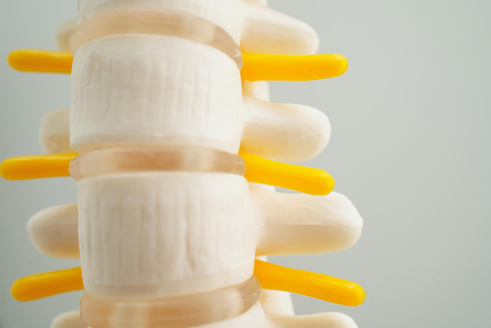 Degenerative Disc Disease  Lackawanna, NY