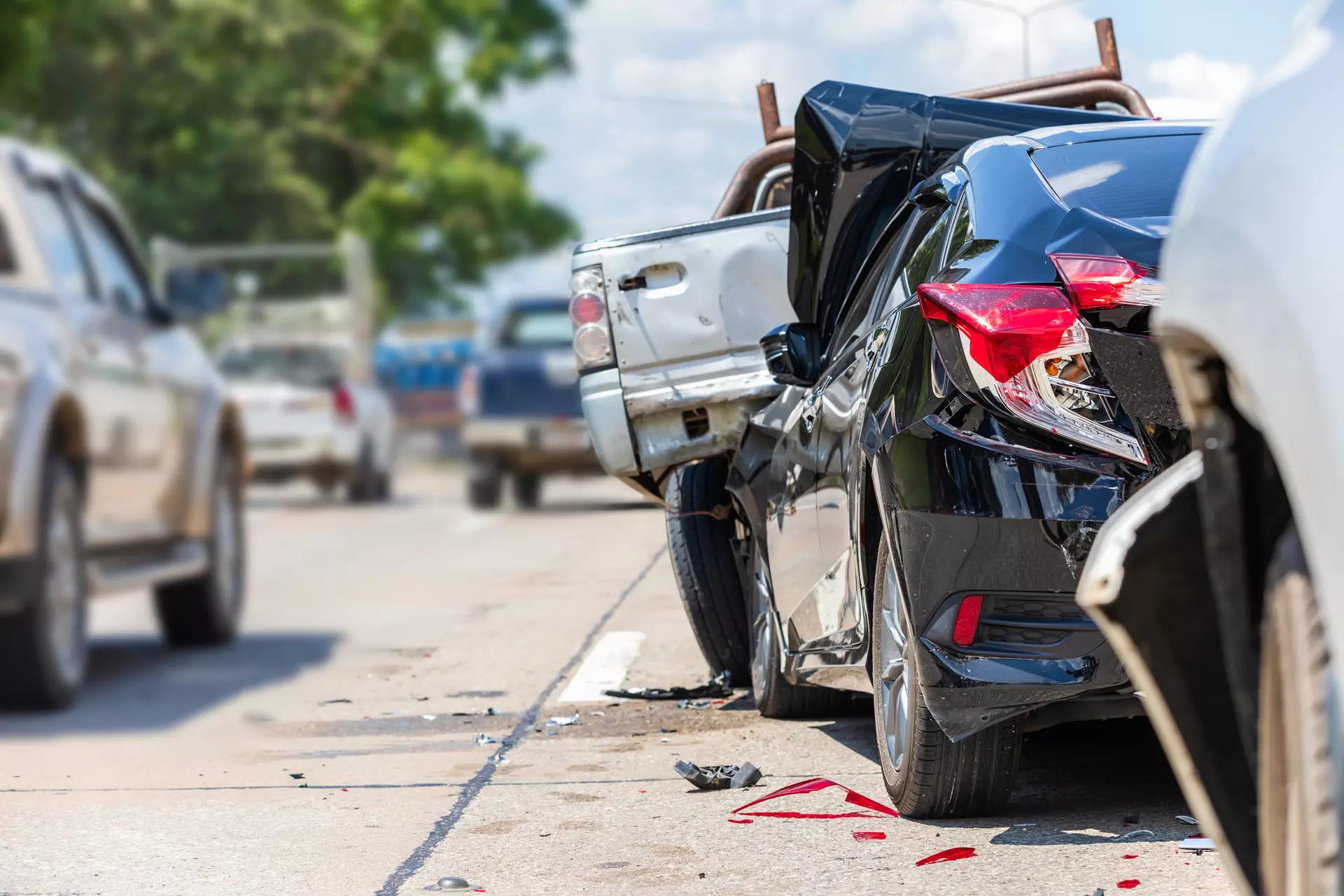 Auto Accident Injuries Treated in Lackawanna